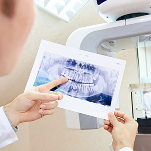 The image shows a dental professional holding up a photograph of a dental X-ray, pointing at it with a pointer.