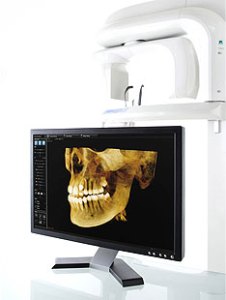monitor displaying 3D cone beam image of upper and lower jaws